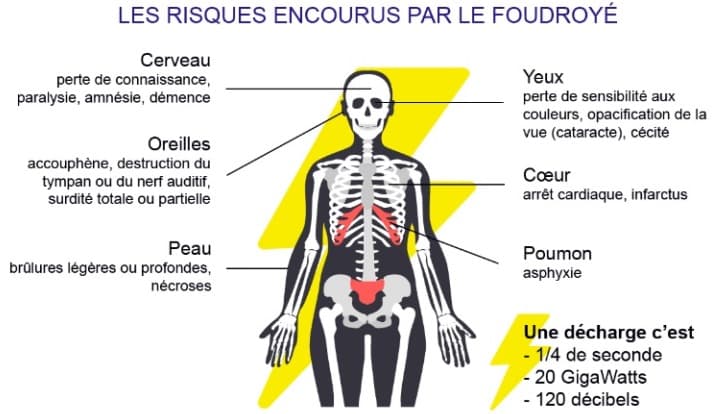 Image d'illustration pour Keraunopathologie : quand la foudre frappe le corps humain